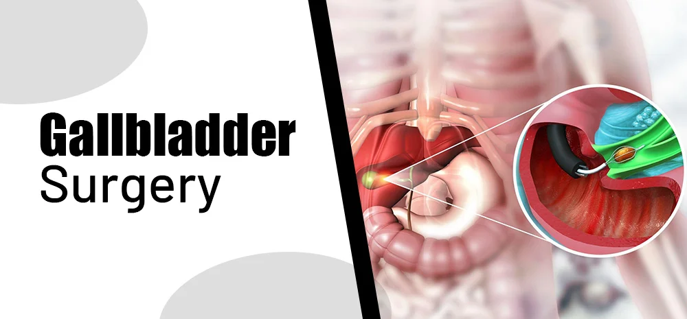 Robotic Surgery