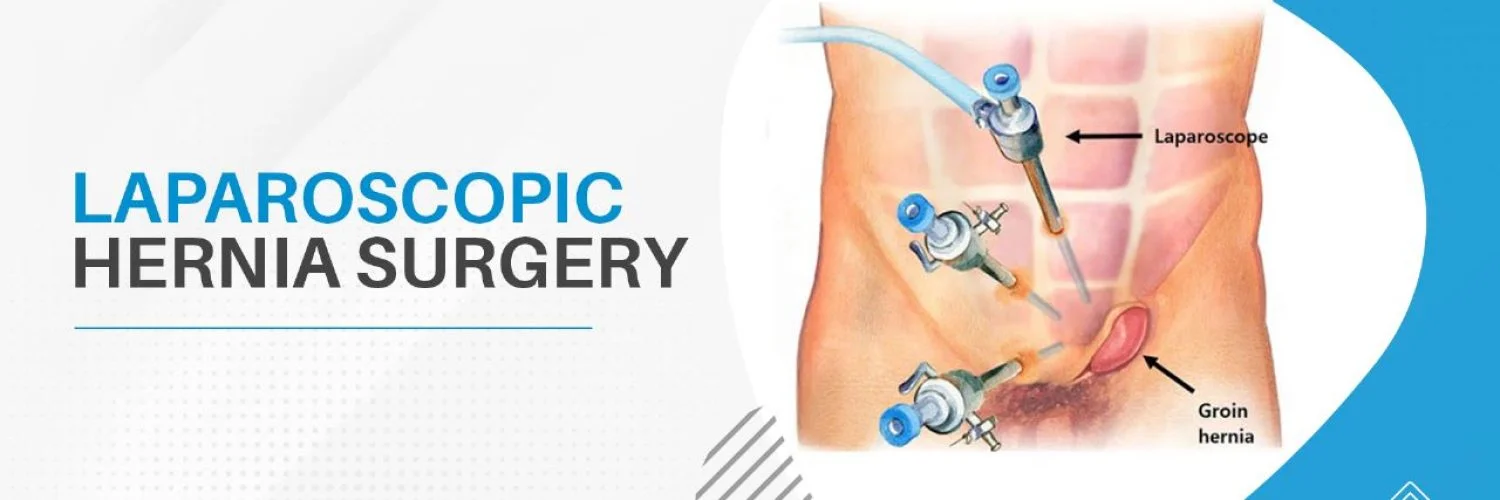 Robotic Surgery