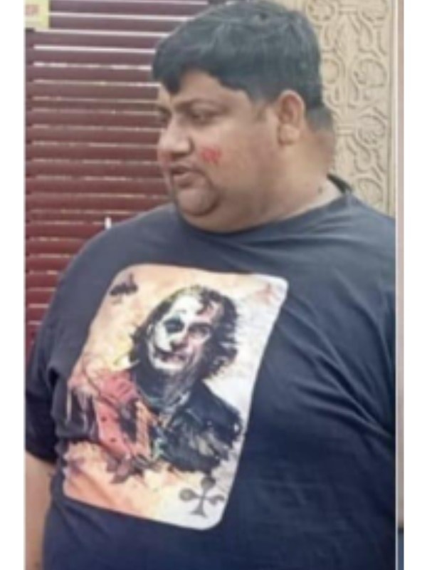 Before Weight Loss